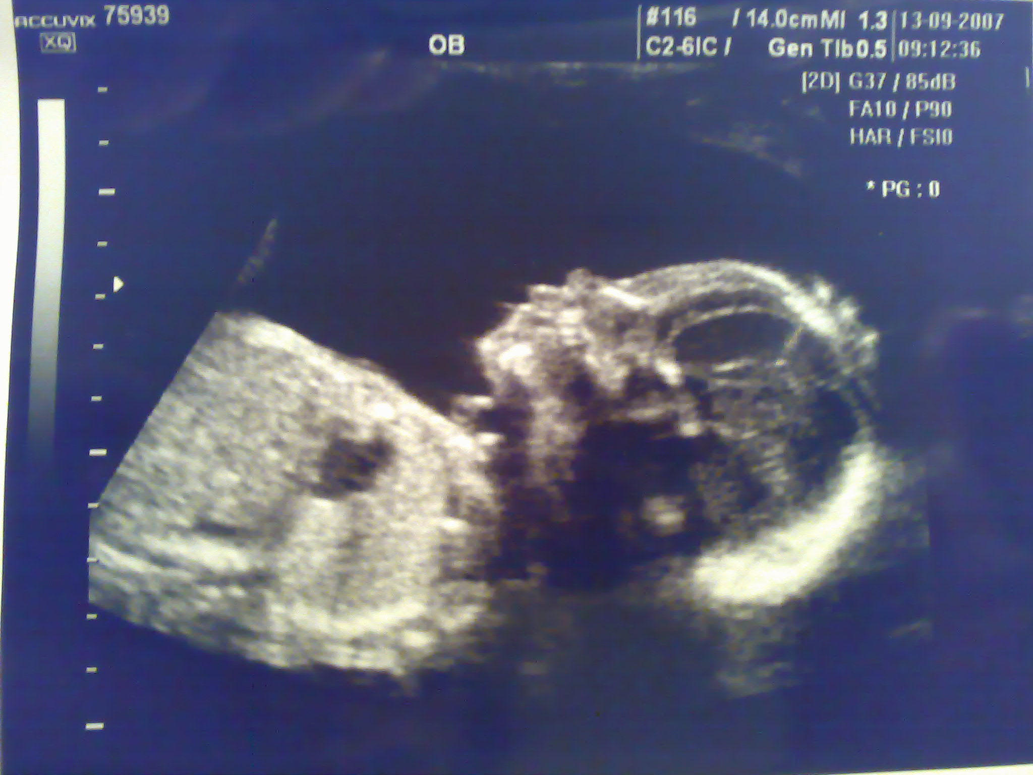 scan piccy